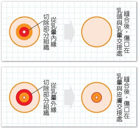 乳暈黑點|女性正常乳暈直徑3